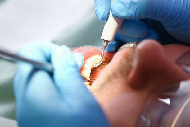 Best Urgent Care for Lost Fillings or Crowns in Okawvle, IL