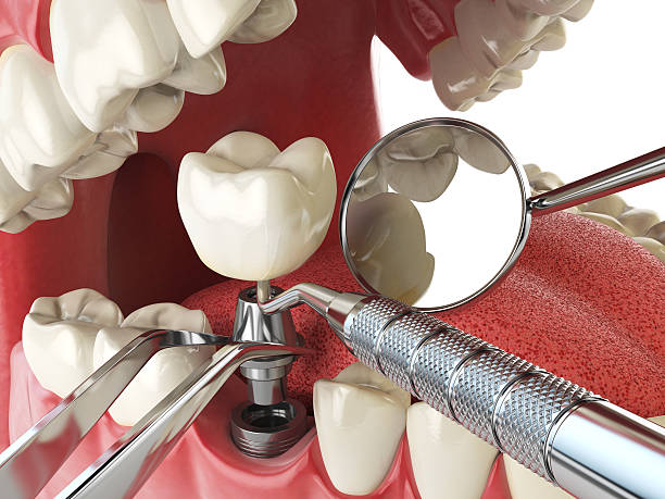 Best Emergency TMJ Treatment in Okawvle, IL