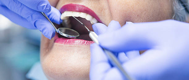 Best Same-Day Emergency Dental Services in Okawvle, IL
